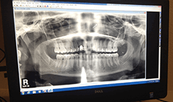 Instant Digital X-rays