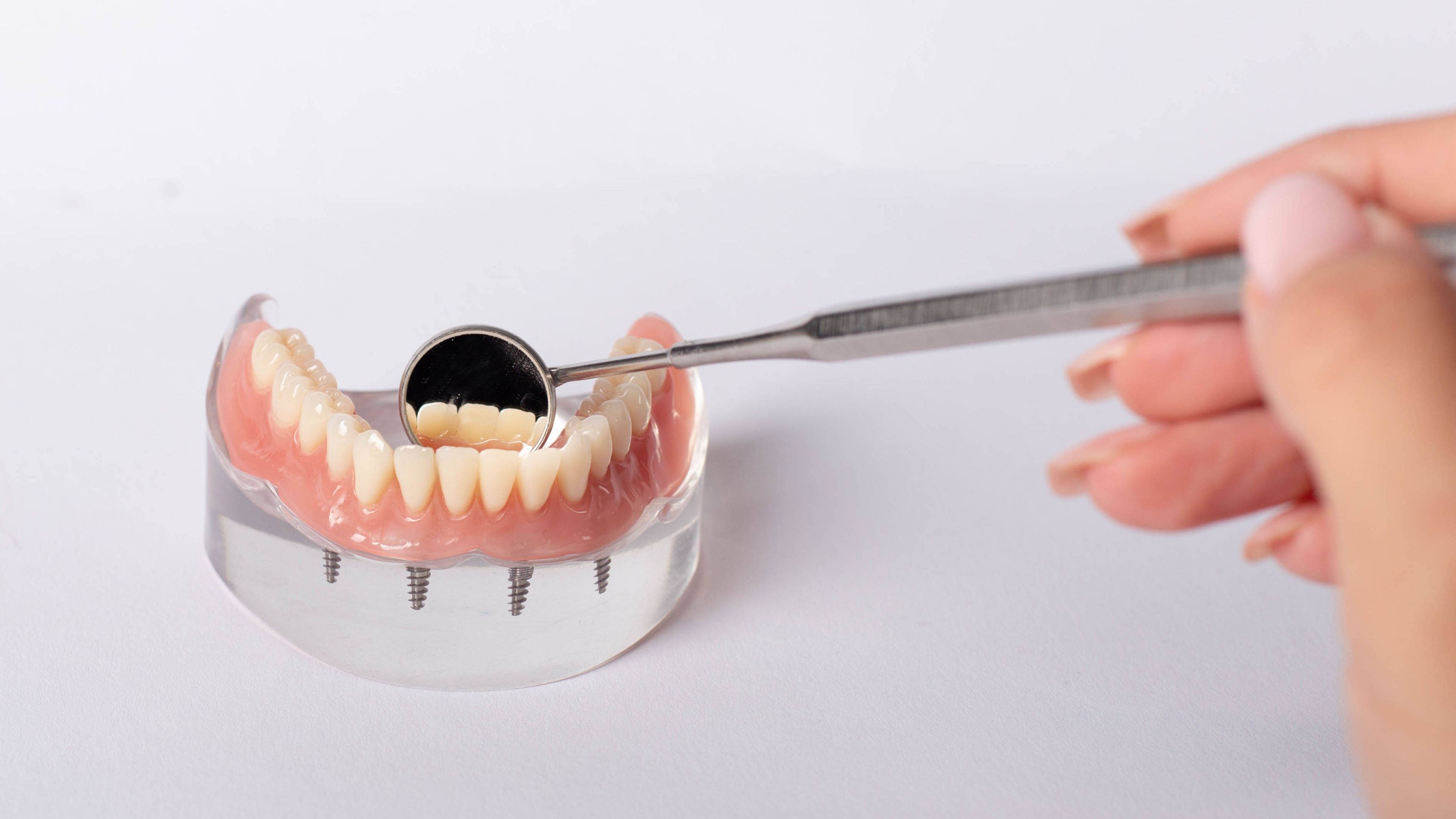 implant supported denture here. All on X